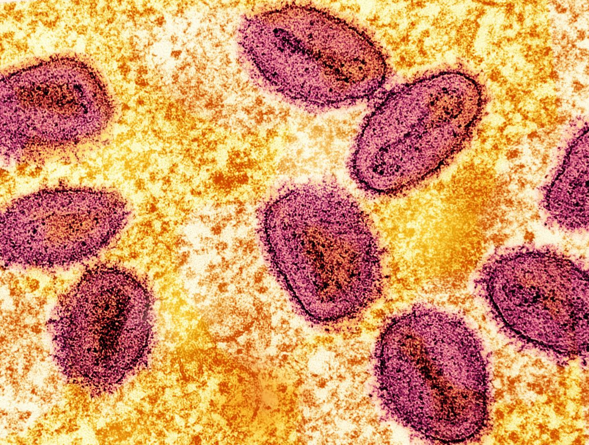 Eine Darstellung des Mpox-Virus.